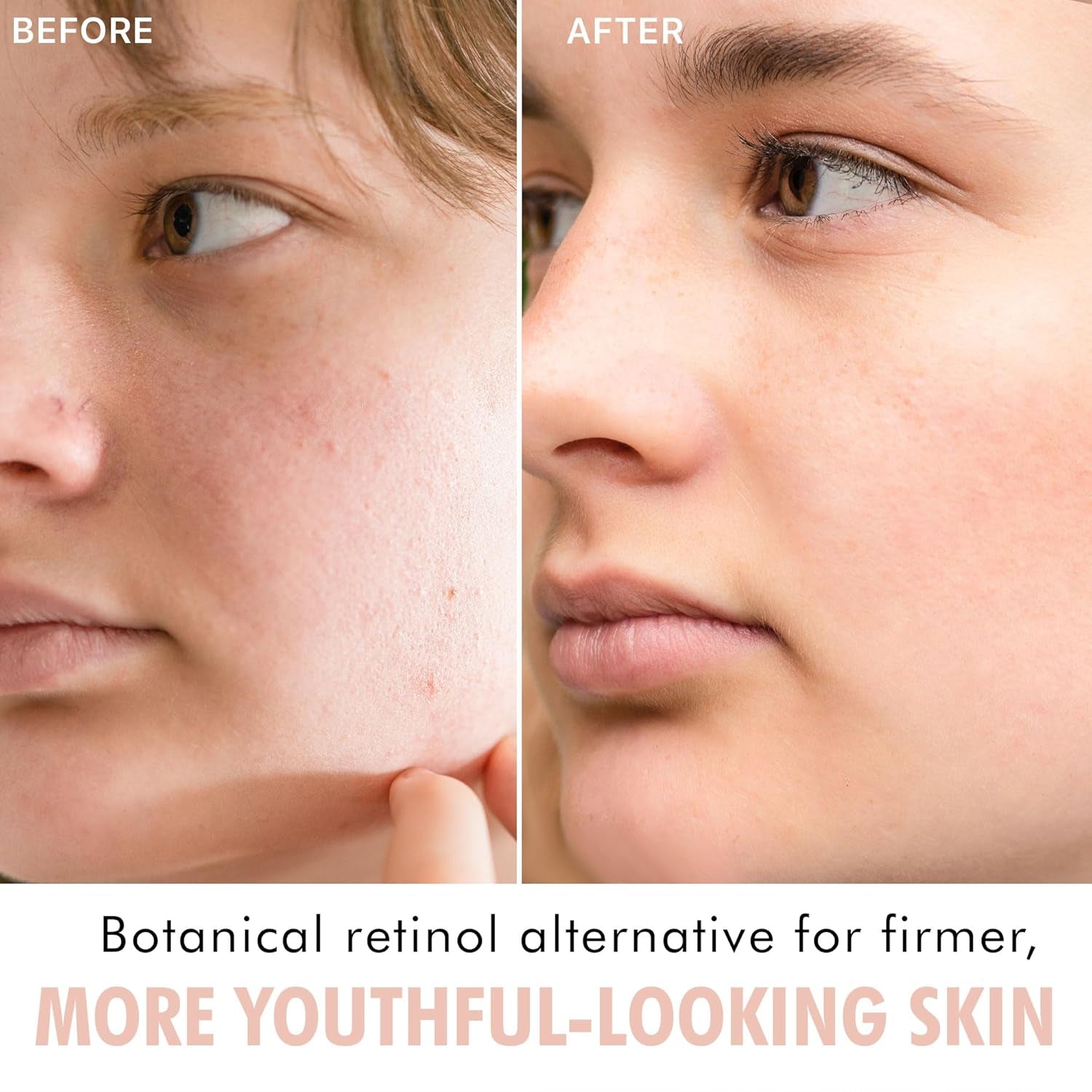 Bio Retinol Alternative Bakuchiol Serum - Smooths Skin & Reduces Fine Lines, USA Made with Natural & Organic Ingredients, Anti-Aging Skin Care Formula, Vegan, Cruelty Free